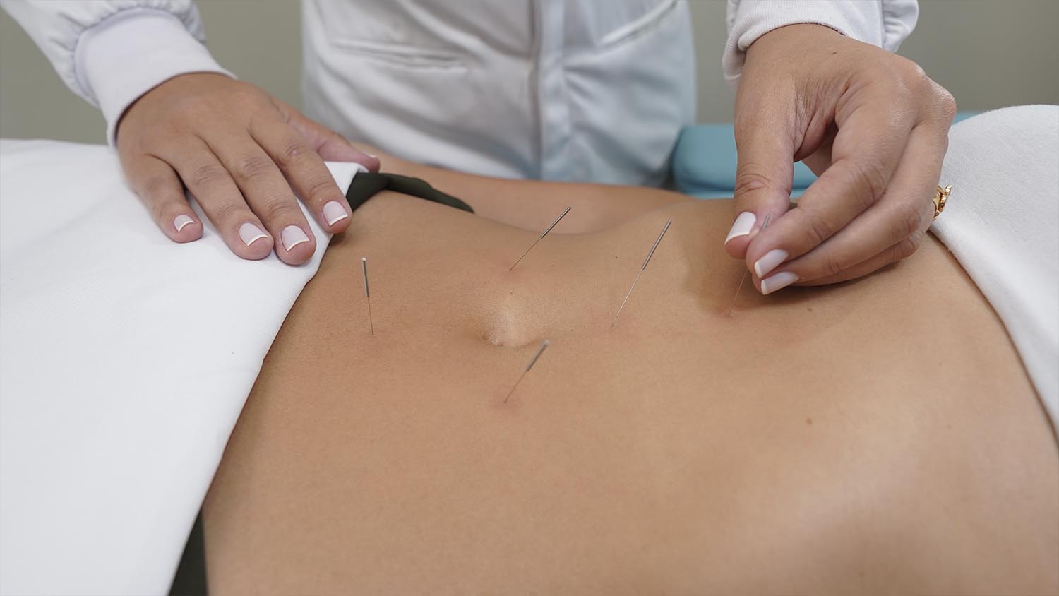 Acupuntura em Brasília DF Dra Jaqueline Ramos MTC